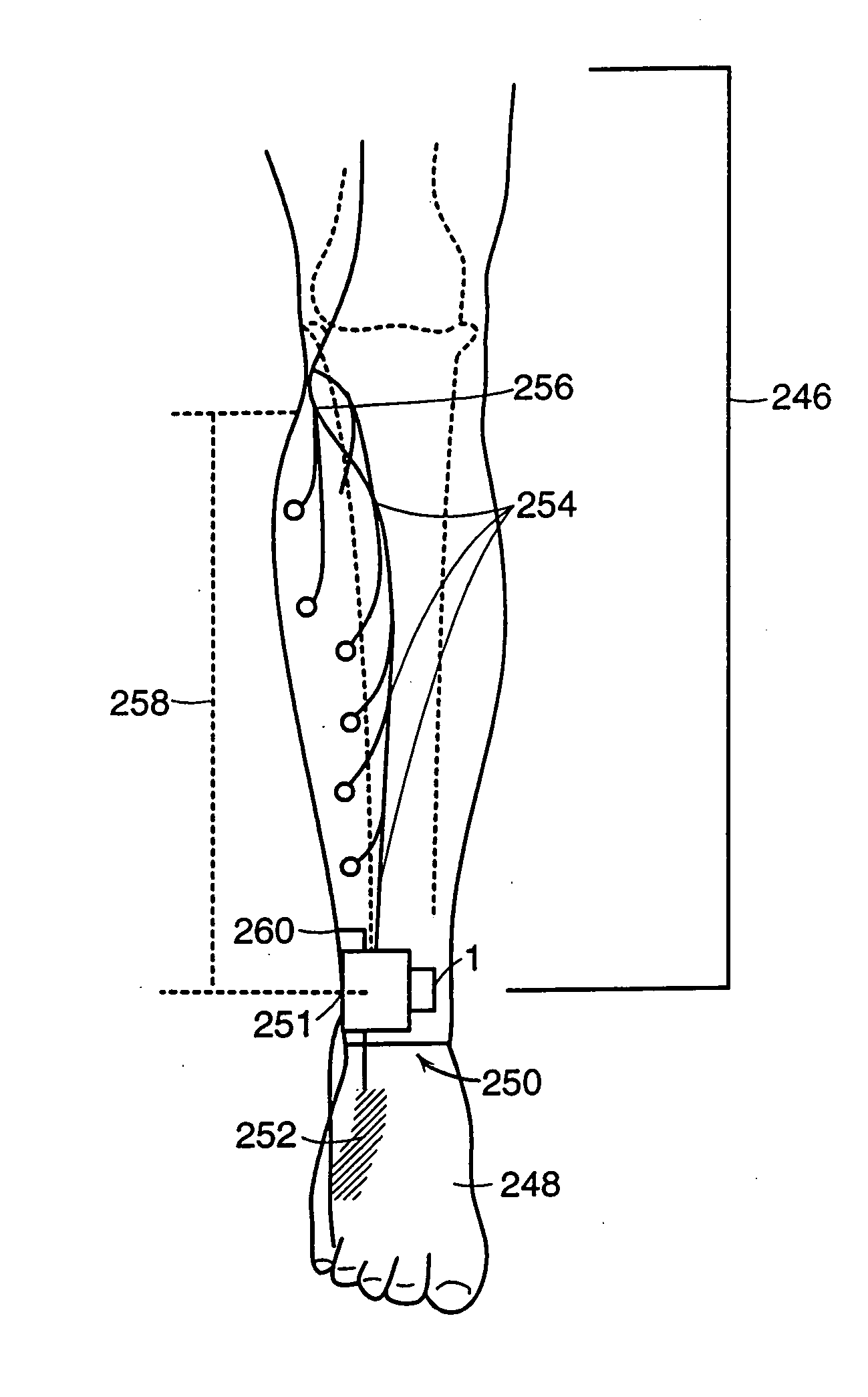 Methods for the assessment of neuromuscular function by F-wave latency