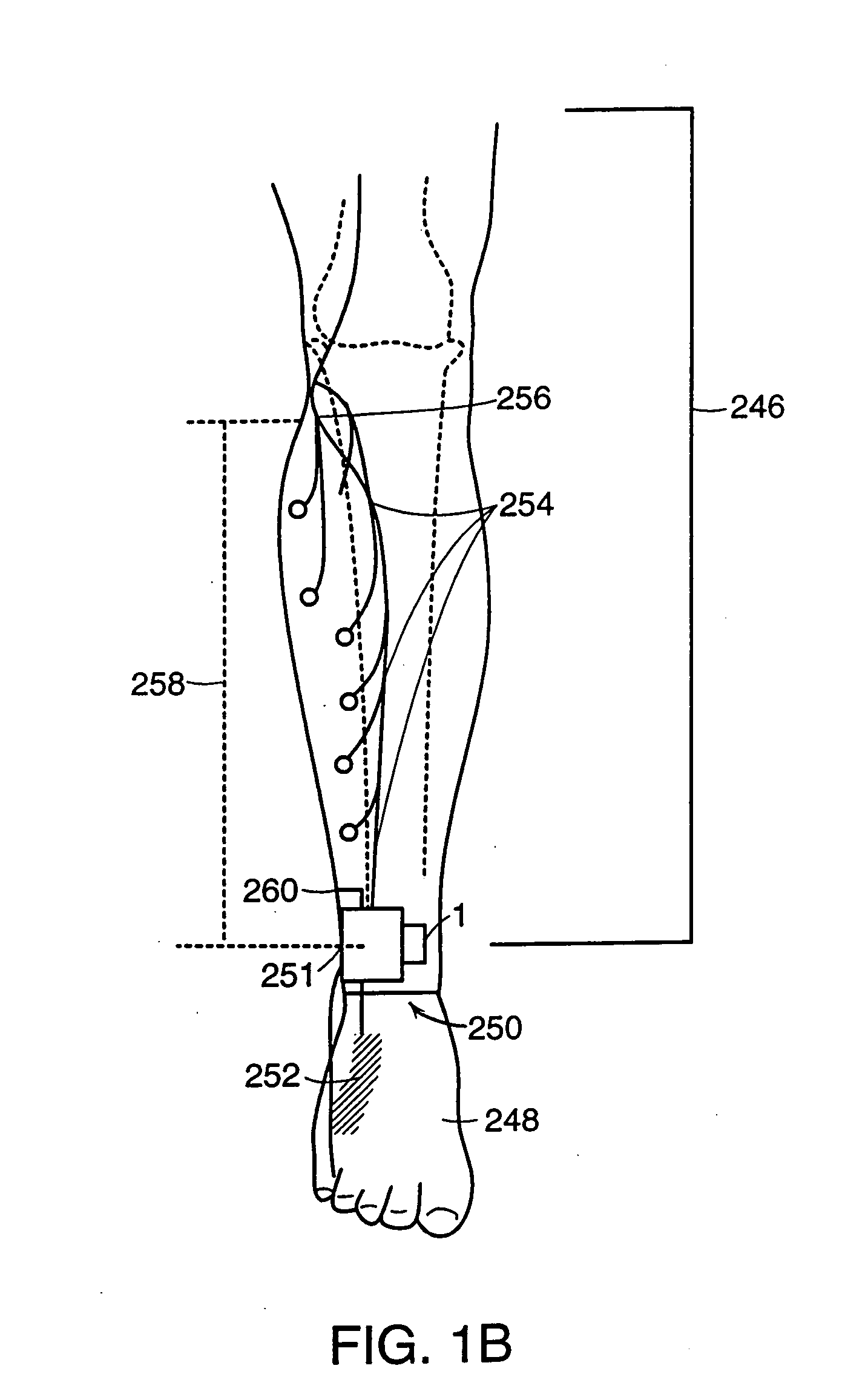 Methods for the assessment of neuromuscular function by F-wave latency