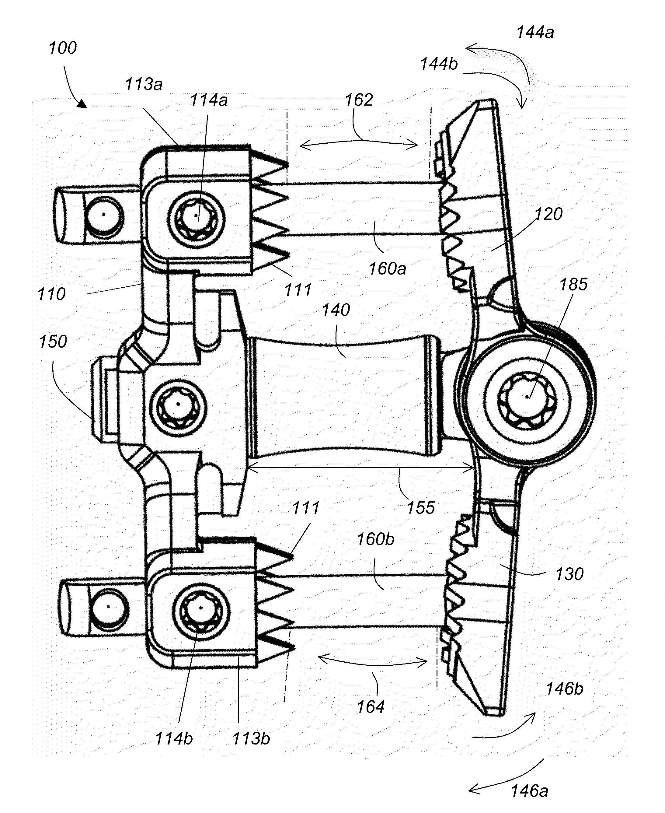 Spinous process fixation implant