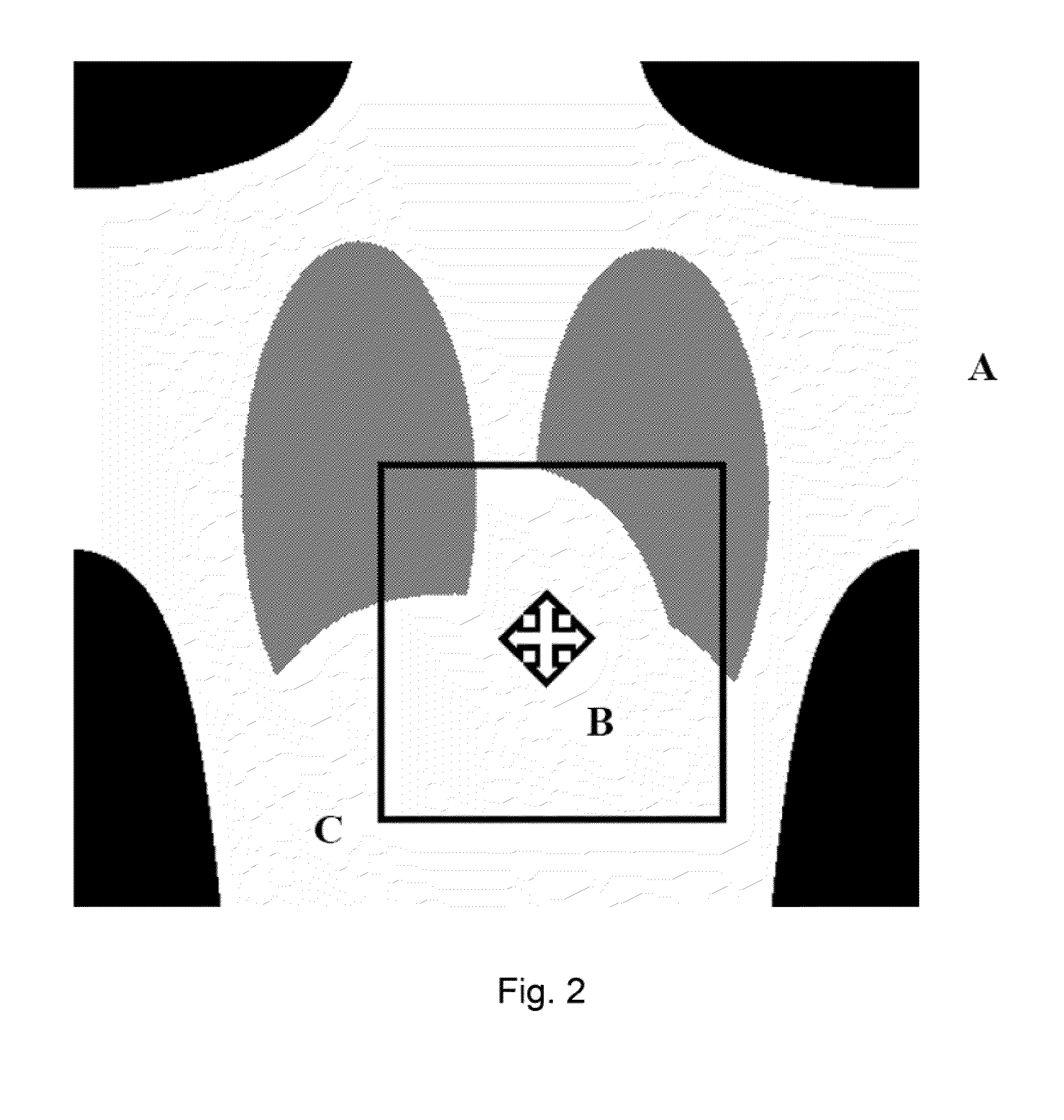 Method and System for Changing Image Density and Contrast