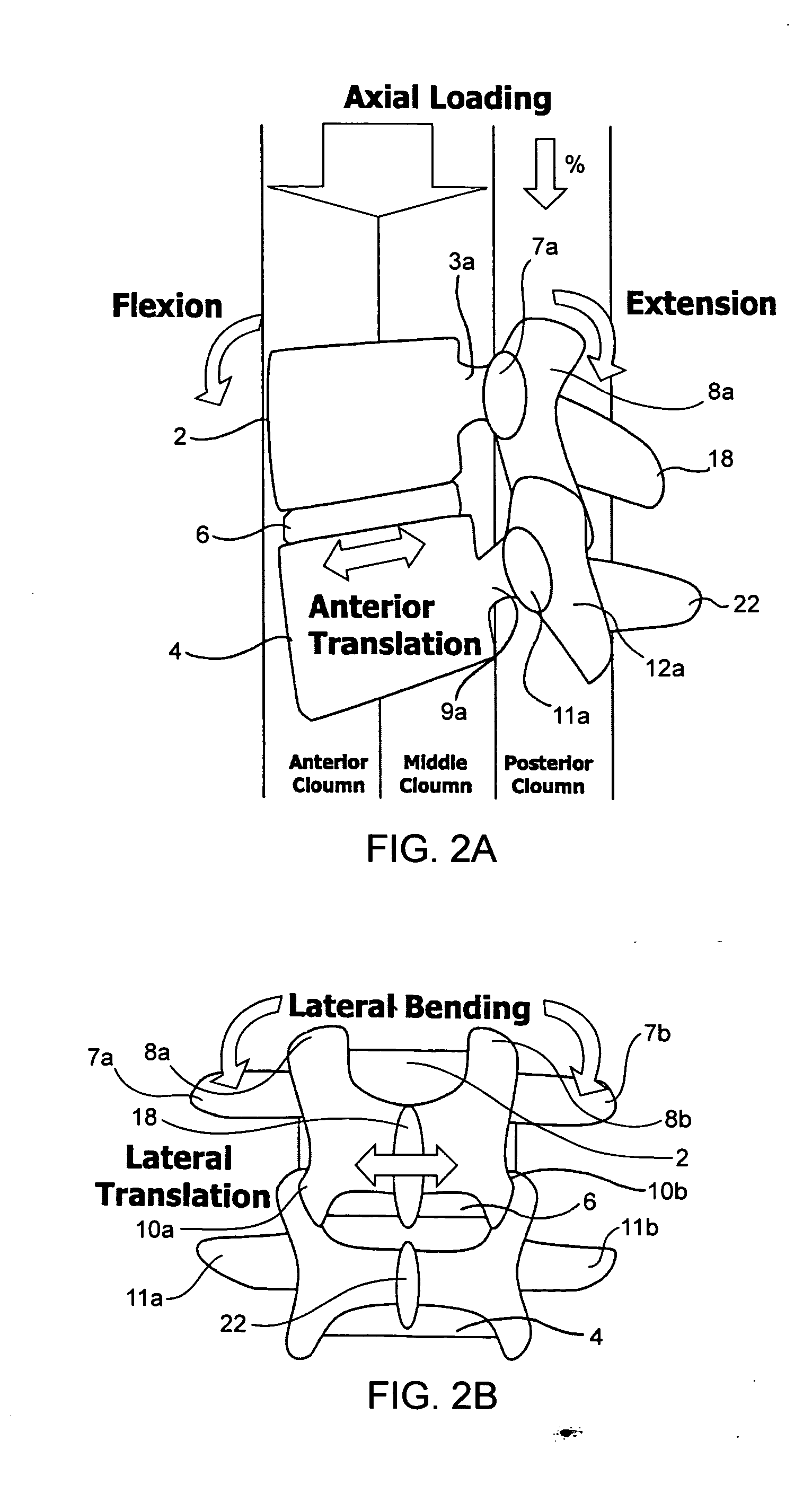 Systems and methods for stabilization of bone structures