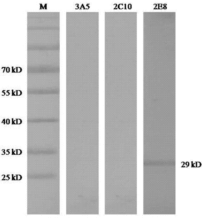 Porcine circovirus type 2 antigen capture ELISA kit