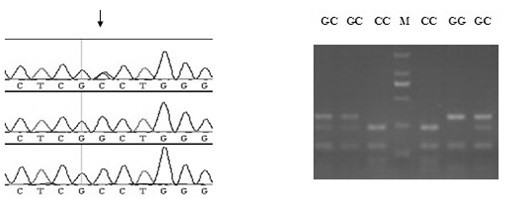 SNP (Single Nucleotide Polymorphism) marker related to litter size of sow and application thereof