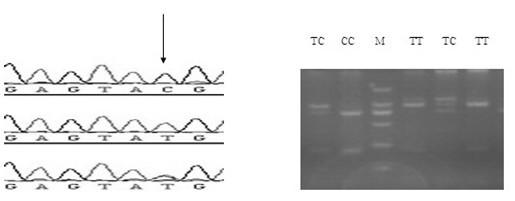 SNP (Single Nucleotide Polymorphism) marker related to litter size of sow and application thereof