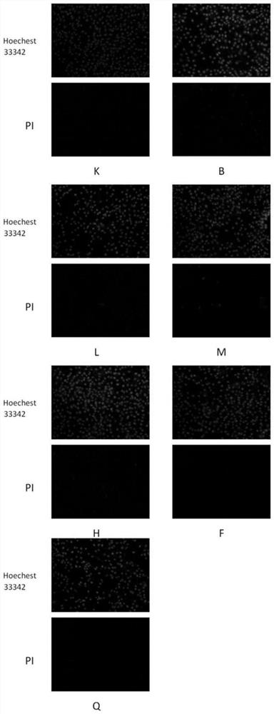 Traditional Chinese medicine composition as well as preparation method and application thereof