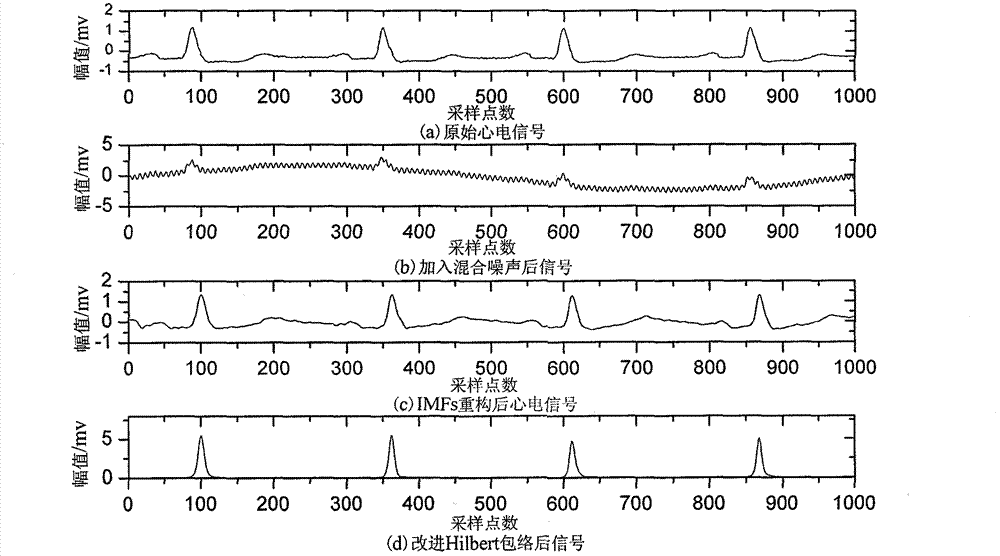 R wave detection algorithm based on extremum field mean mode decomposition and improved Hilbert enveloping