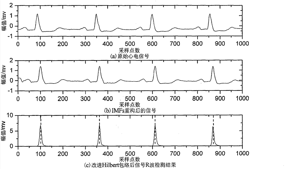 R wave detection algorithm based on extremum field mean mode decomposition and improved Hilbert enveloping