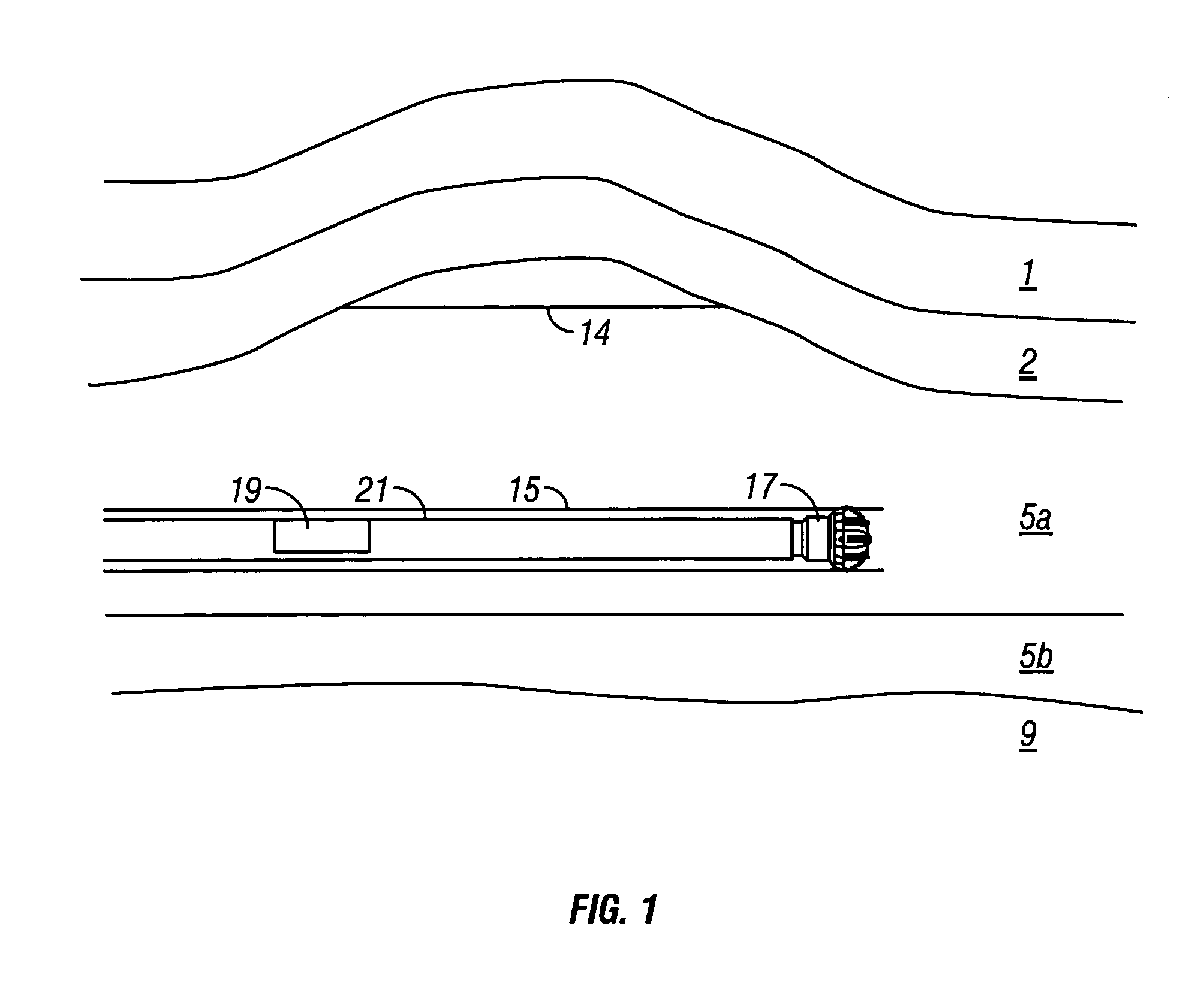 Deep reading propagation resistivity tool for determination of distance to a bed boundary with a transition zone