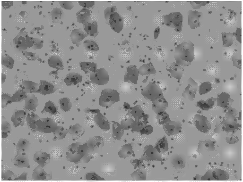 Immune p16&lt;INK4a&gt; antigen preserving liquid used for thin prep liquid-based cytology test and preparation method of same