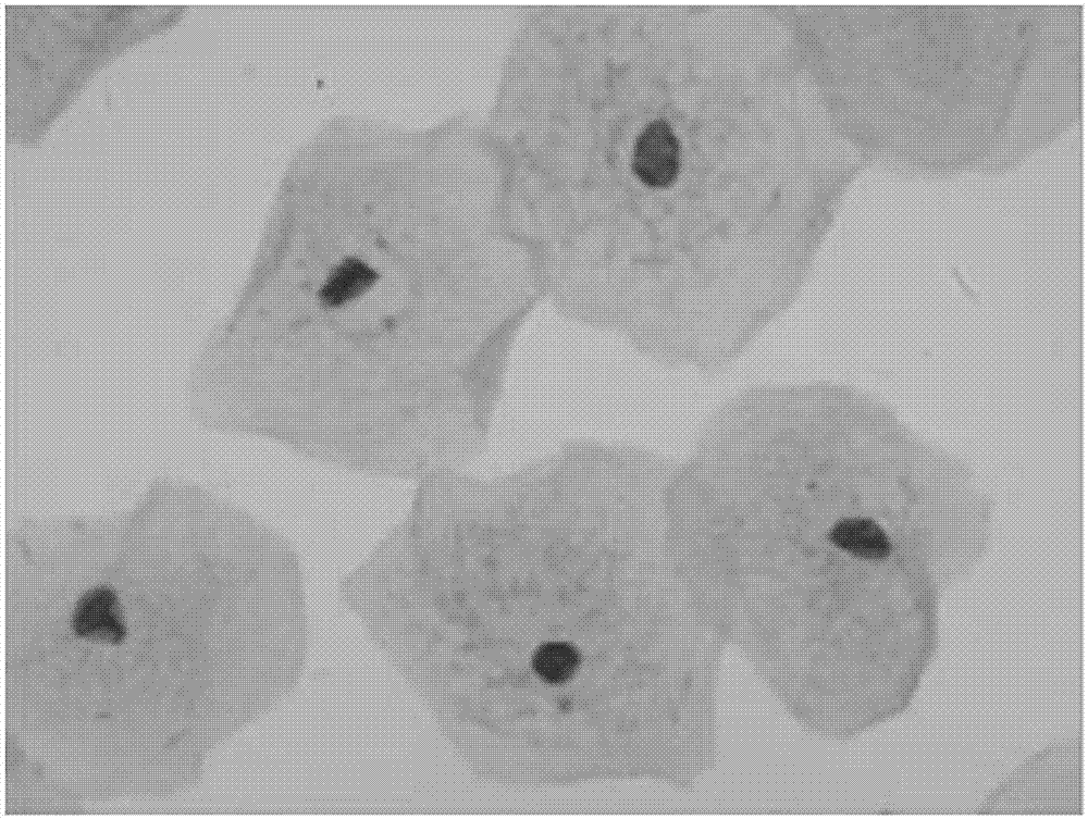 Immune p16&lt;INK4a&gt; antigen preserving liquid used for thin prep liquid-based cytology test and preparation method of same