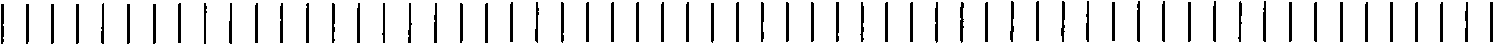 Method for breeding high-nucleic acid yeast and method for preparing ribonucleic acid by using high-nucleic acid yeast