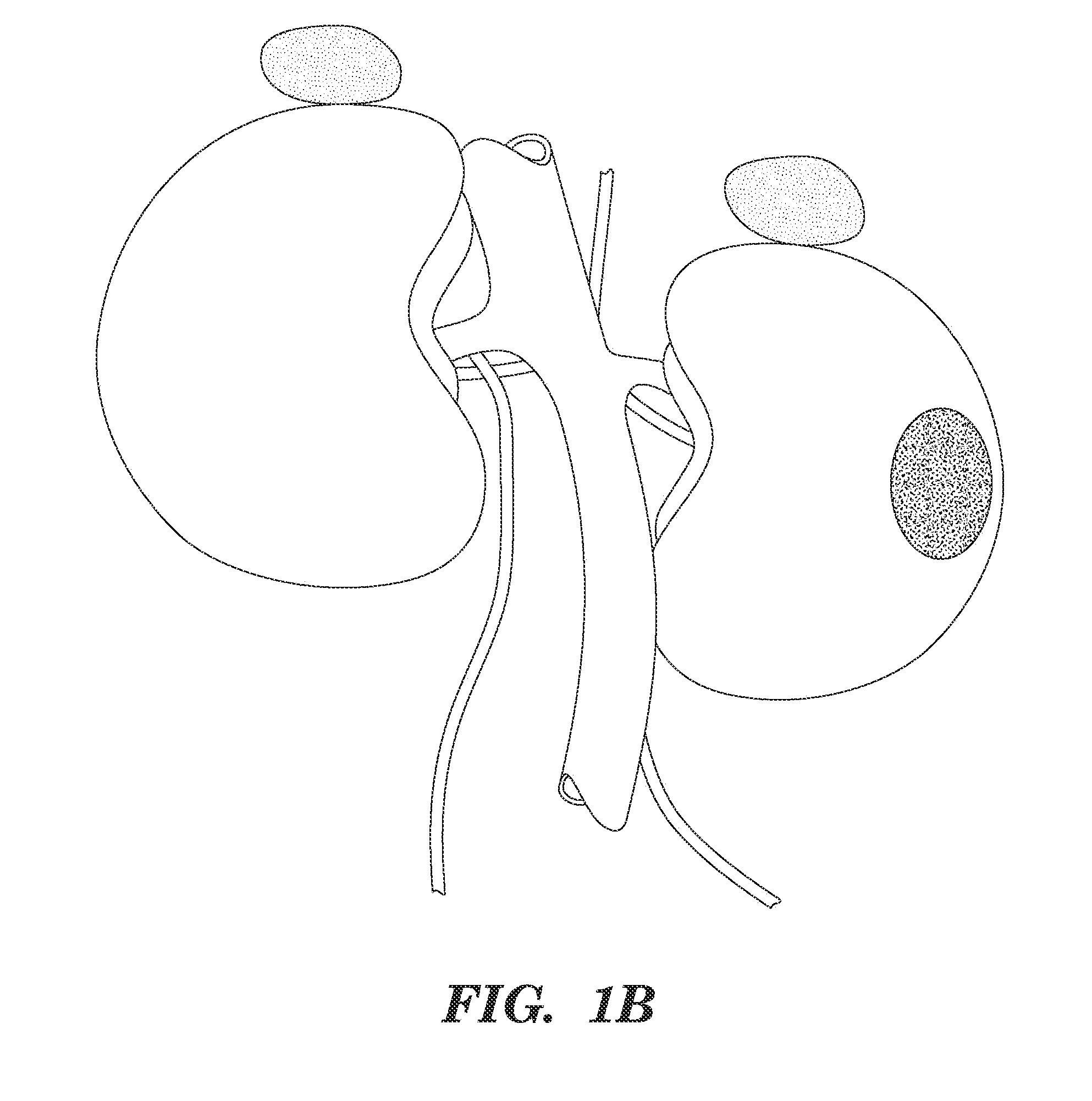 Augmentation of organ function