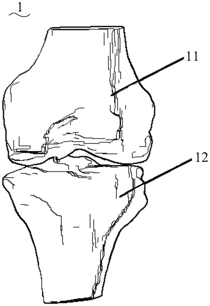 Knee joint osteotomy tool and its manufacturing system and manufacturing method