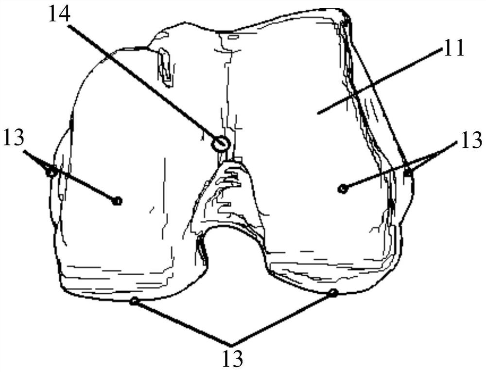 Knee joint osteotomy tool and its manufacturing system and manufacturing method