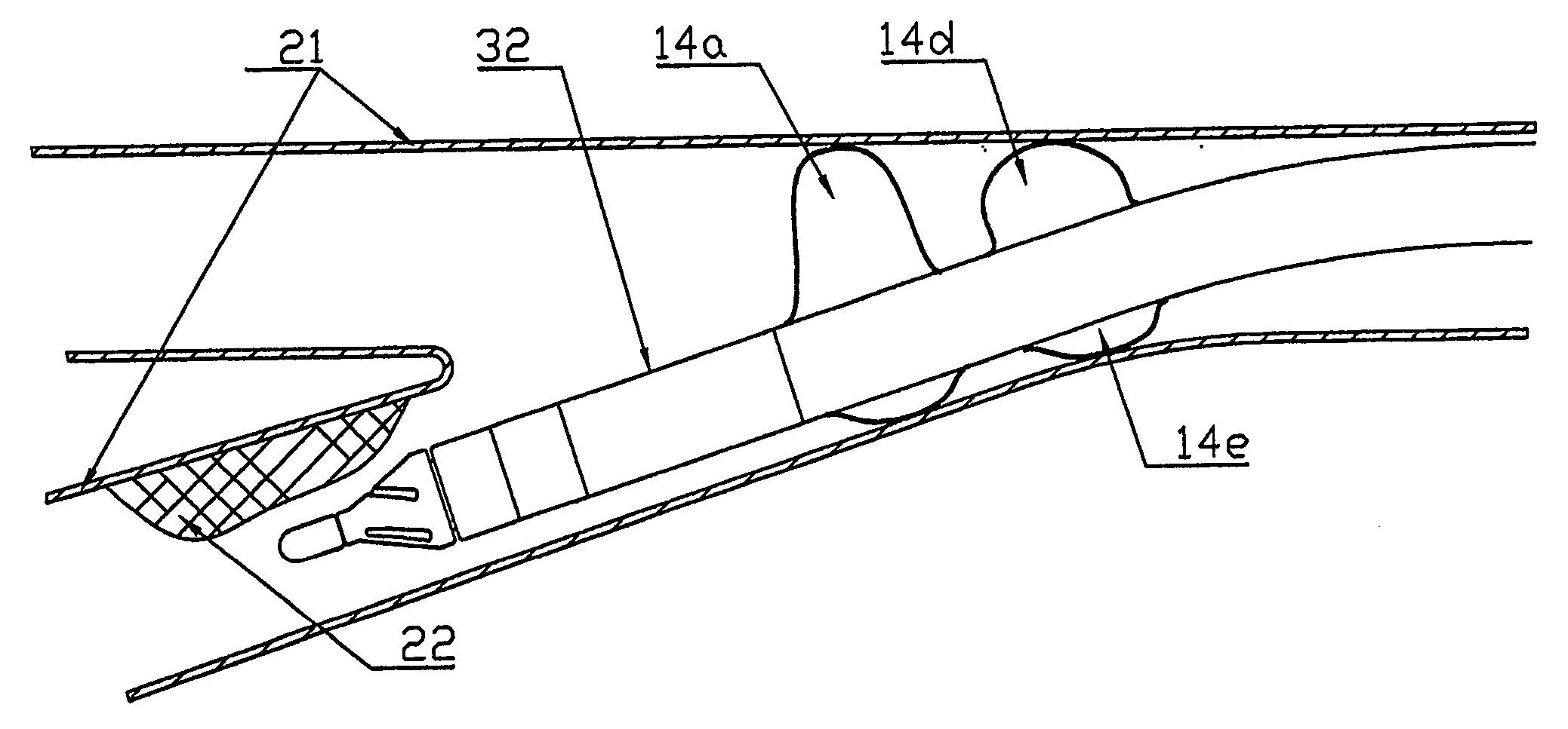 Atherectomy system with imaging guidewire