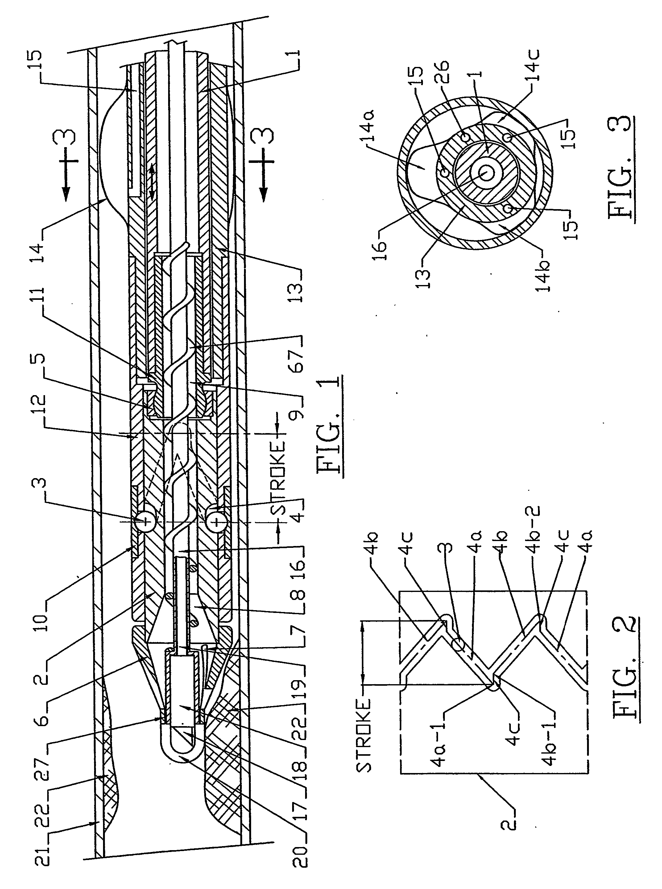 Atherectomy system with imaging guidewire