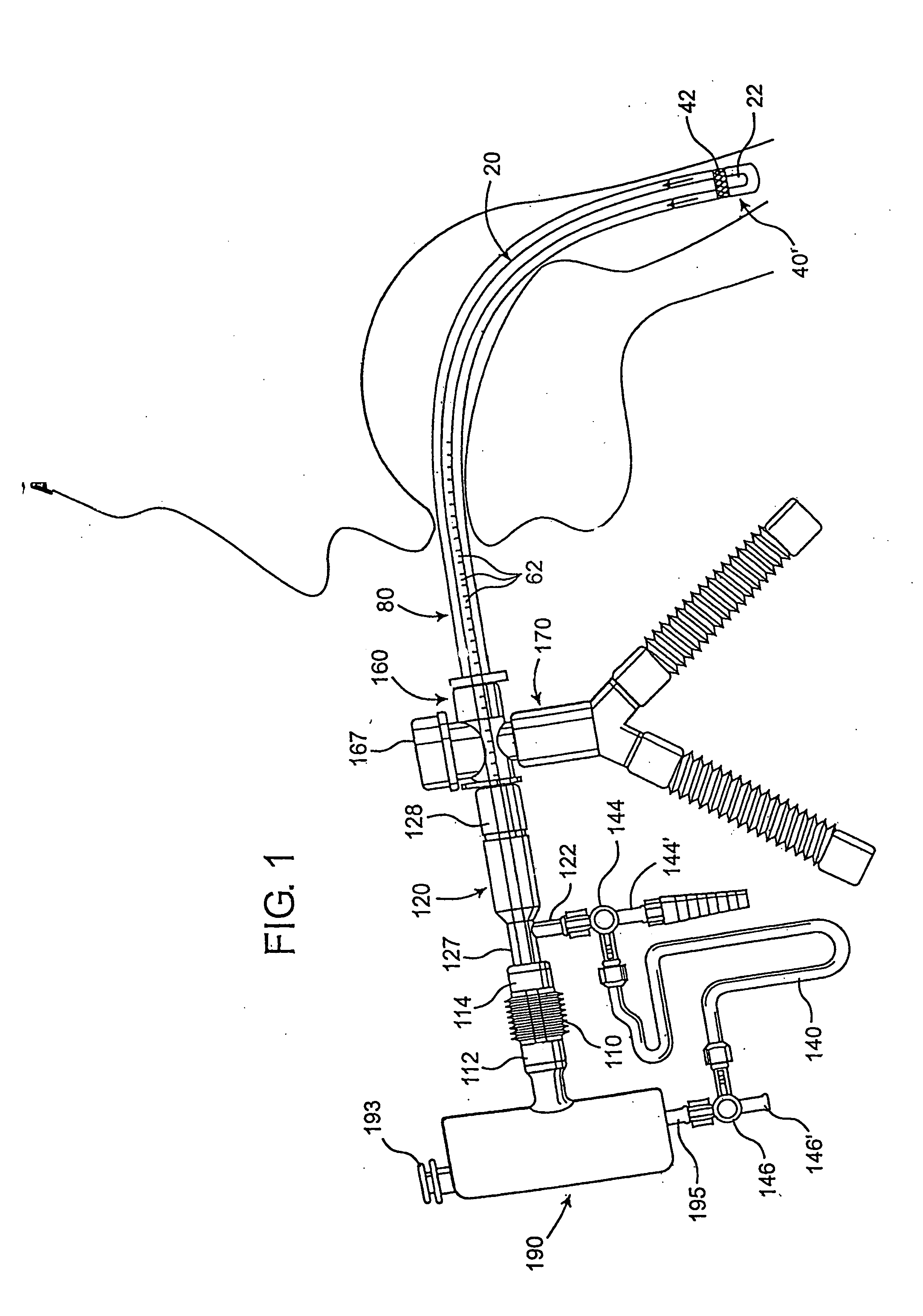 Endotracheal tube cleaning apparatus