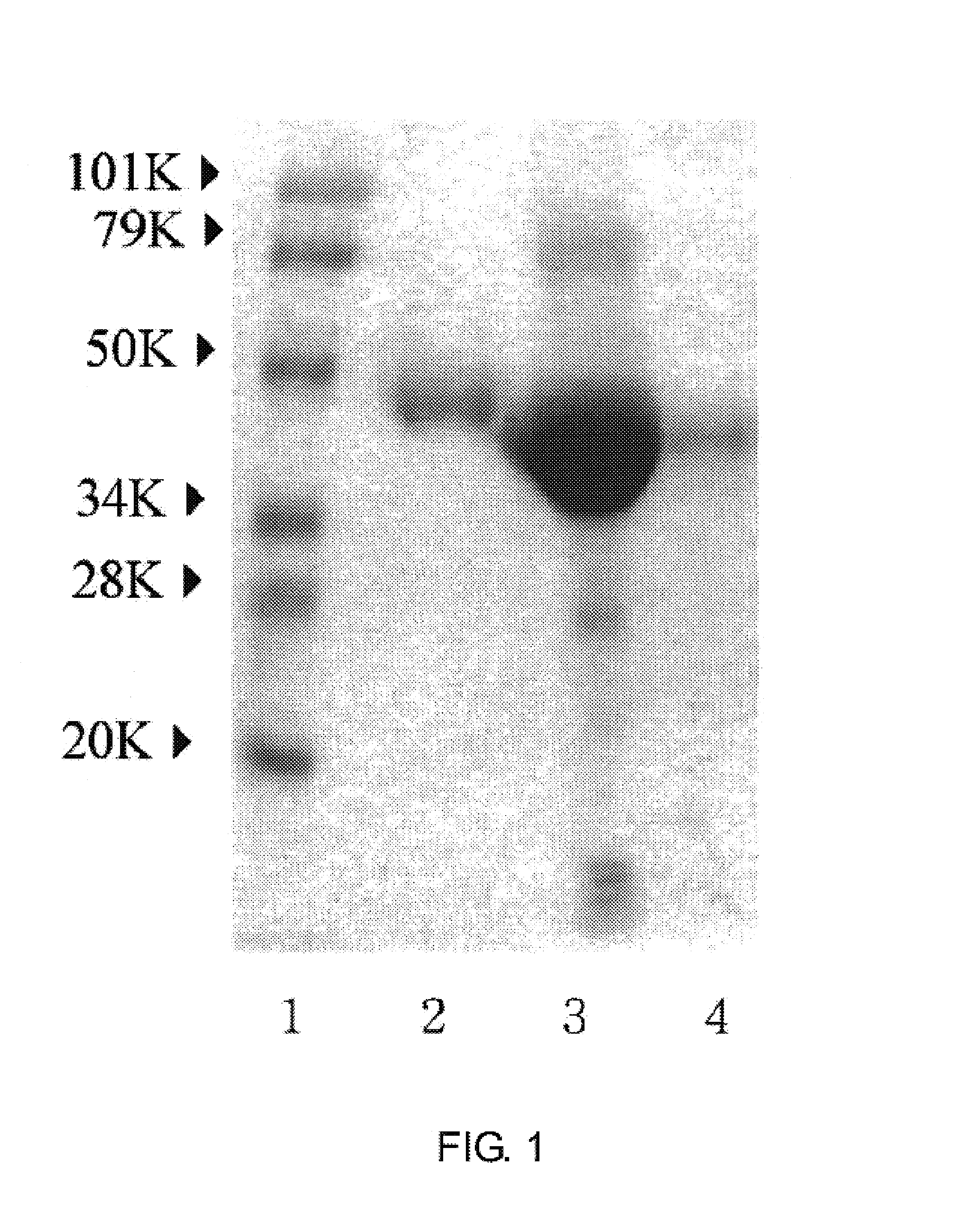 Method for diagnosing liver diseases