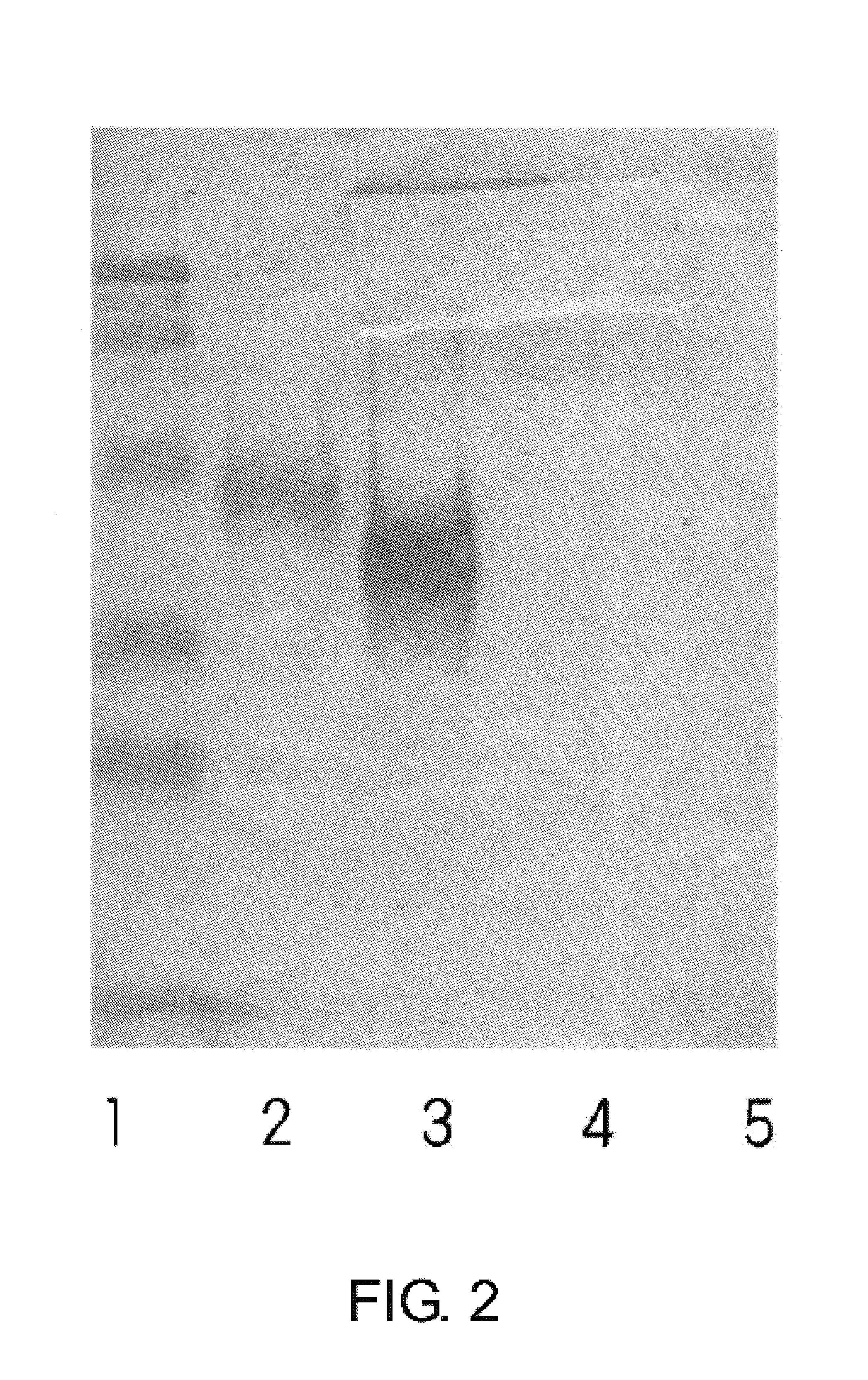 Method for diagnosing liver diseases