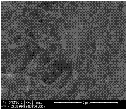 Nano-hydroxyapatite/chitosan/chondroitin sulfuric acid composite stent