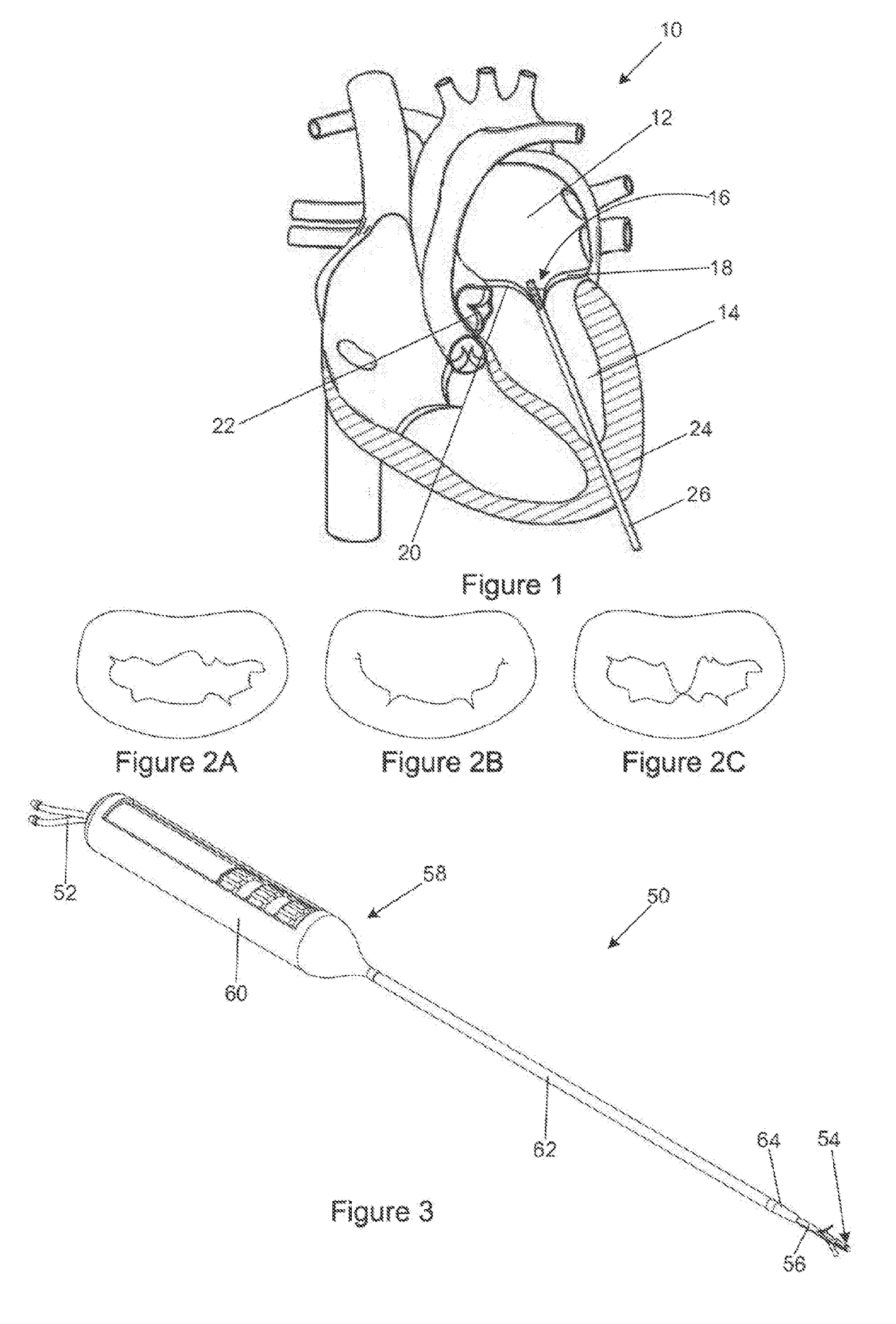 Heart valve leaflet capture device