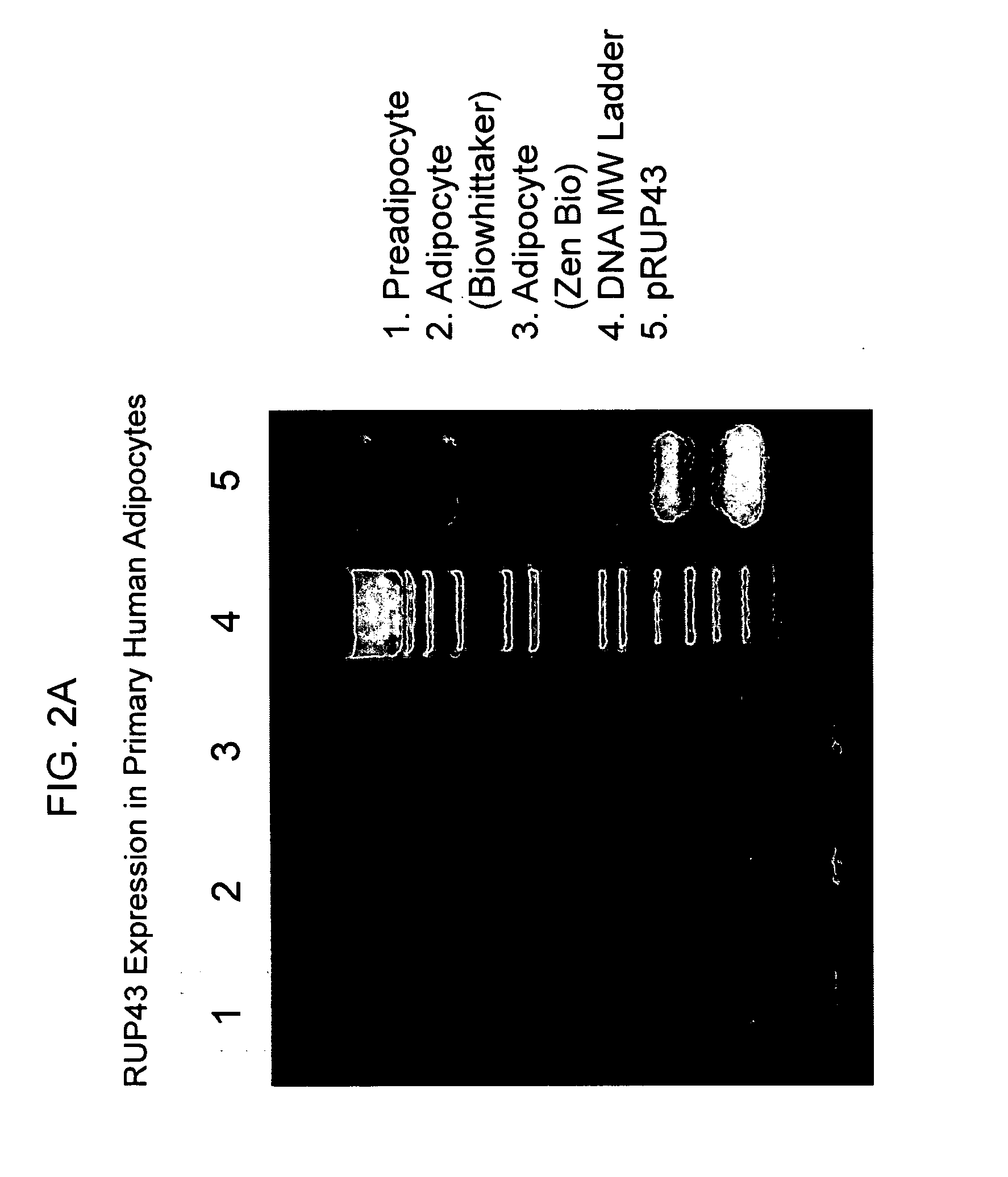 Human G protein-coupled receptor and modulators thereof for the treatment of hyperglycemia and related disorders