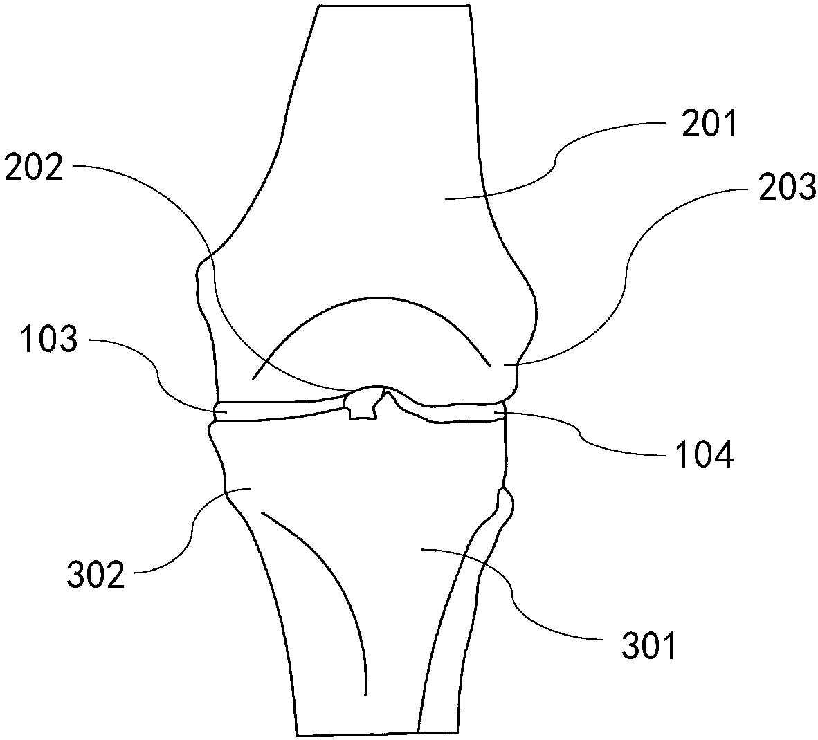 Human body model for knee joint replacement simulation operation