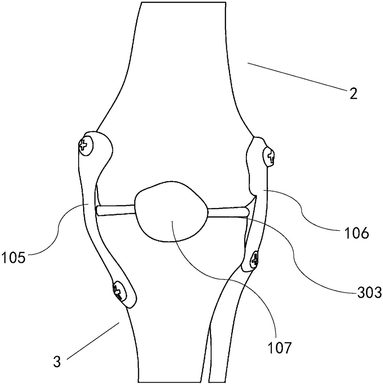 Human body model for knee joint replacement simulation operation