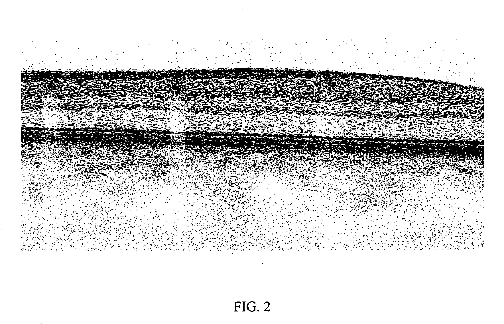 Method of motion correction in optical coherence tomography imaging