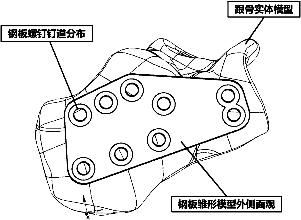 Design method of personalized 3D printing calcaneal plate based on topological optimization