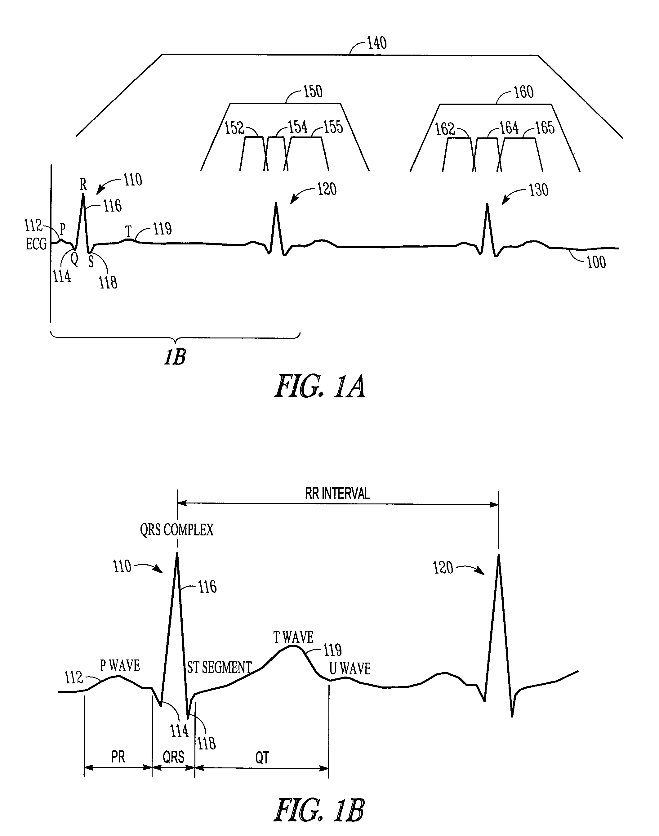 ECG signal power vector detection of ischemia or infarction