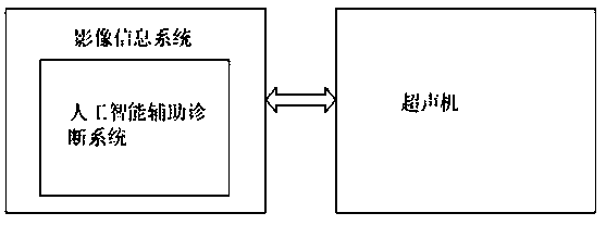 Artificial intelligence ultrasonic auxiliary system and application thereof