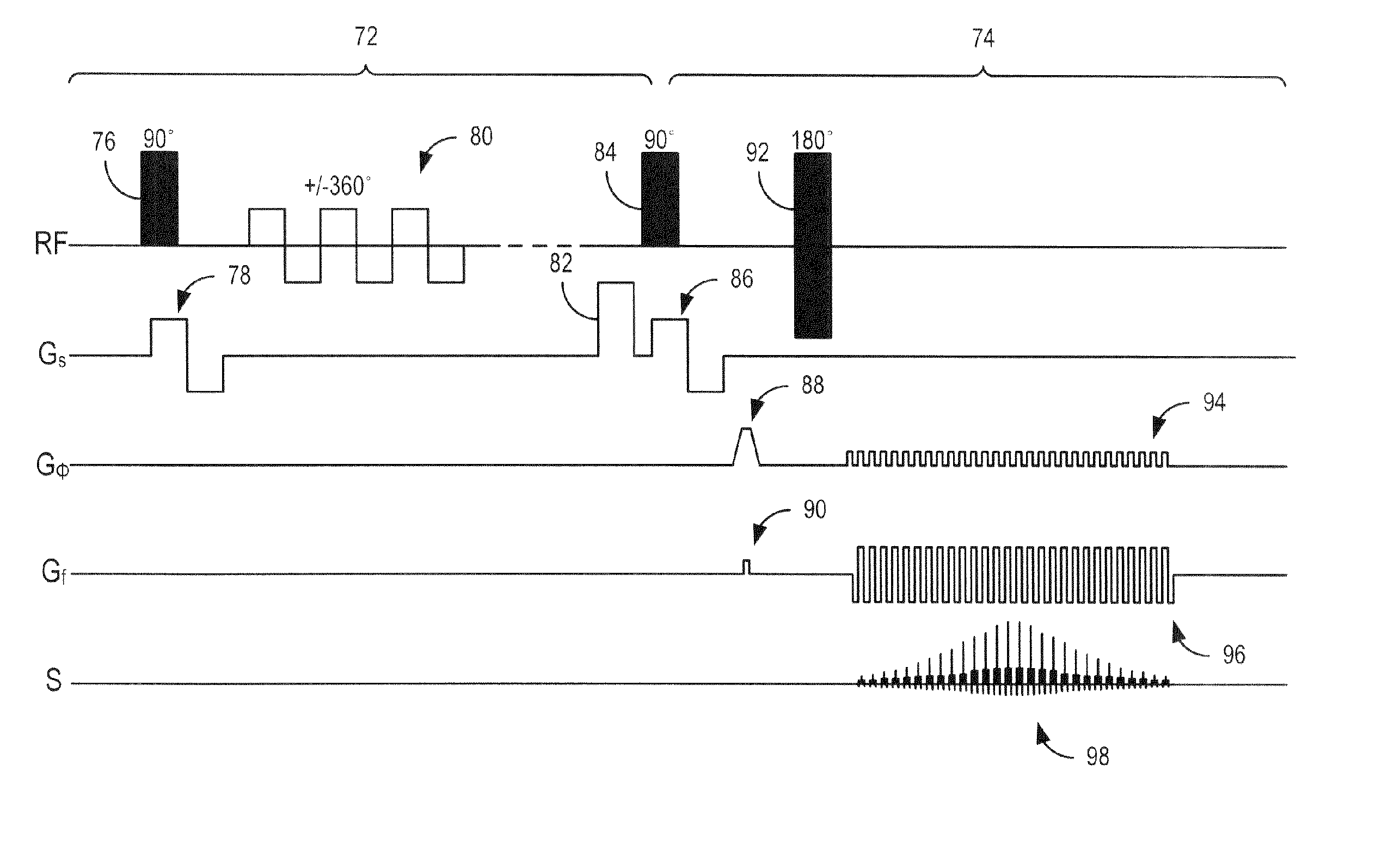 Method and apparatus of background suppression in mr imaging using spin locking