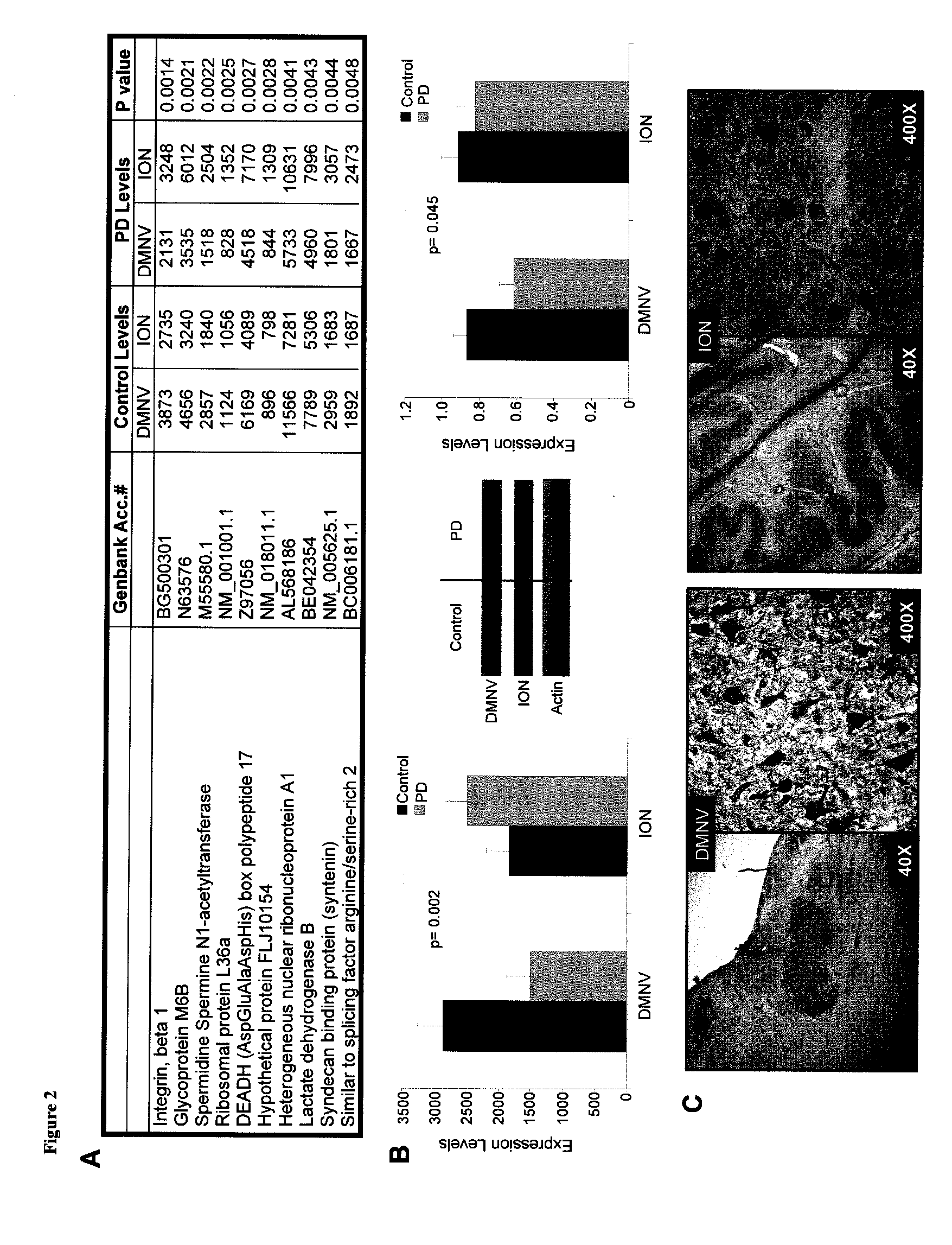 Polyamine inhibitors for the treatment and prevention of parkinson's disease