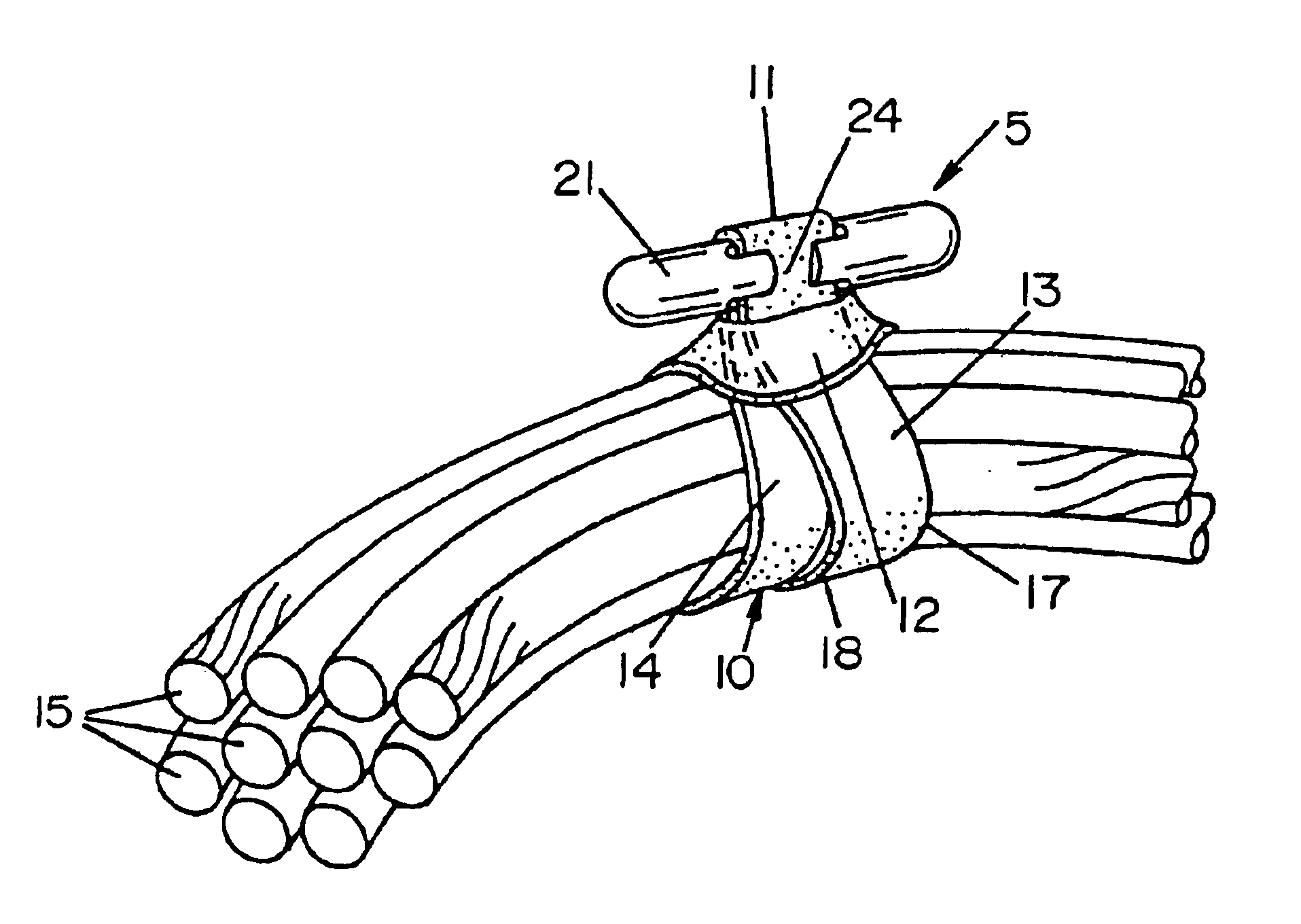 Rubber band retainer apparatus