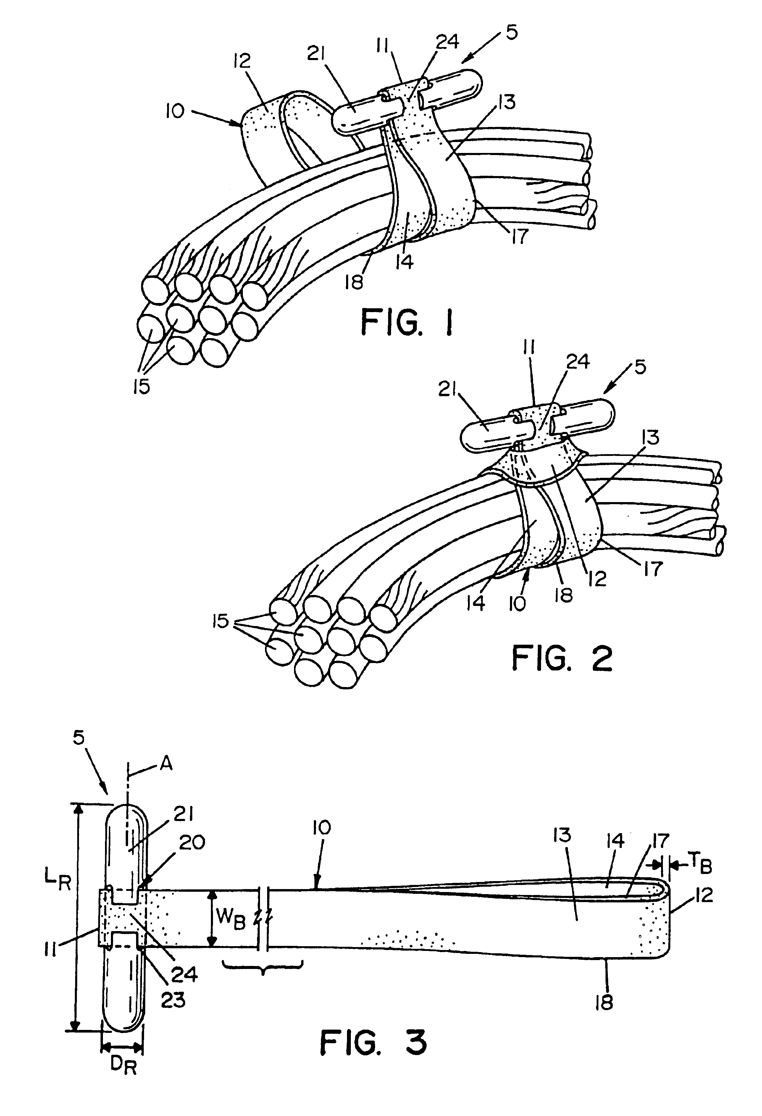 Rubber band retainer apparatus