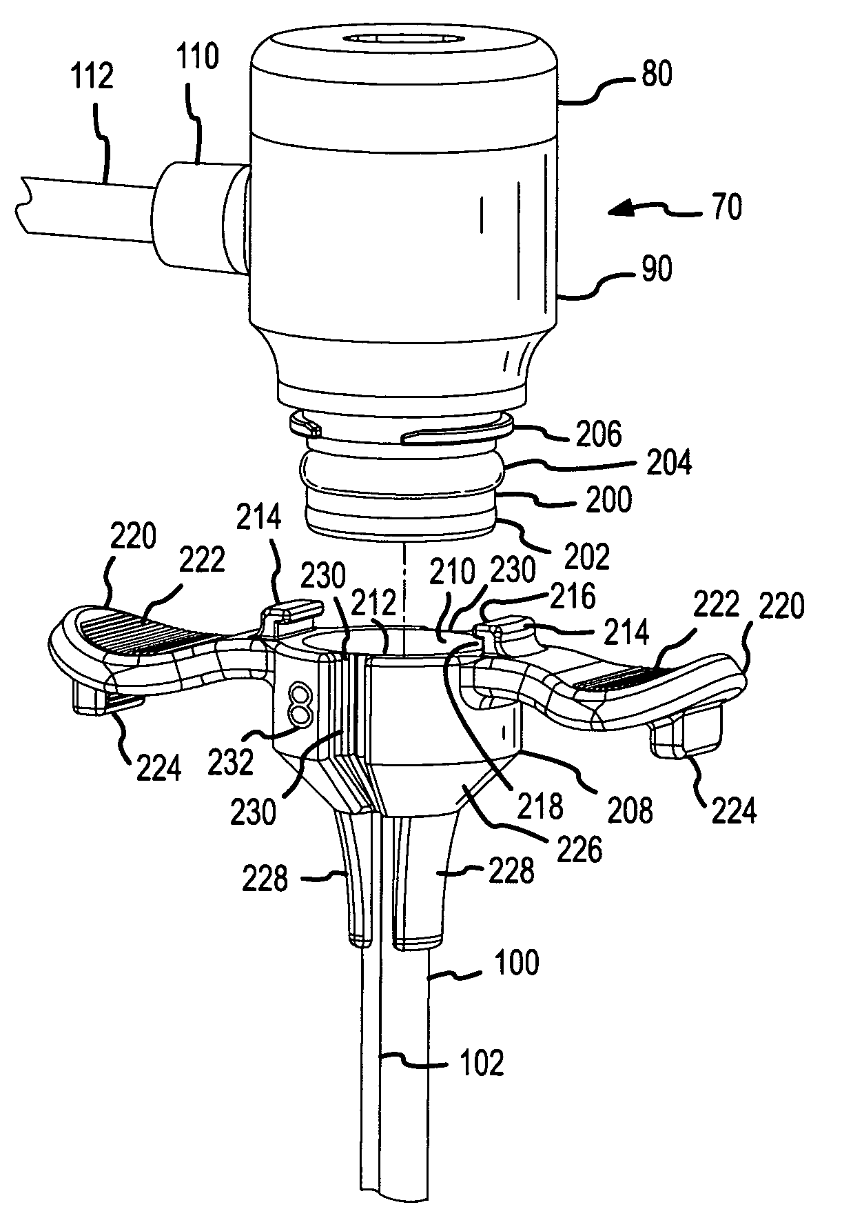 Detachable hemostasis valve and splittable sheath assembly