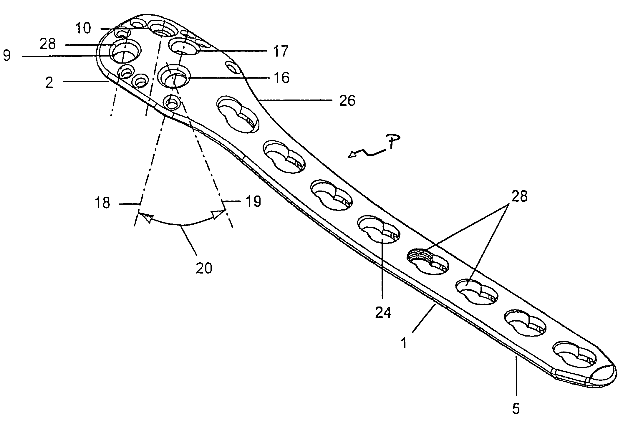 Bone plate