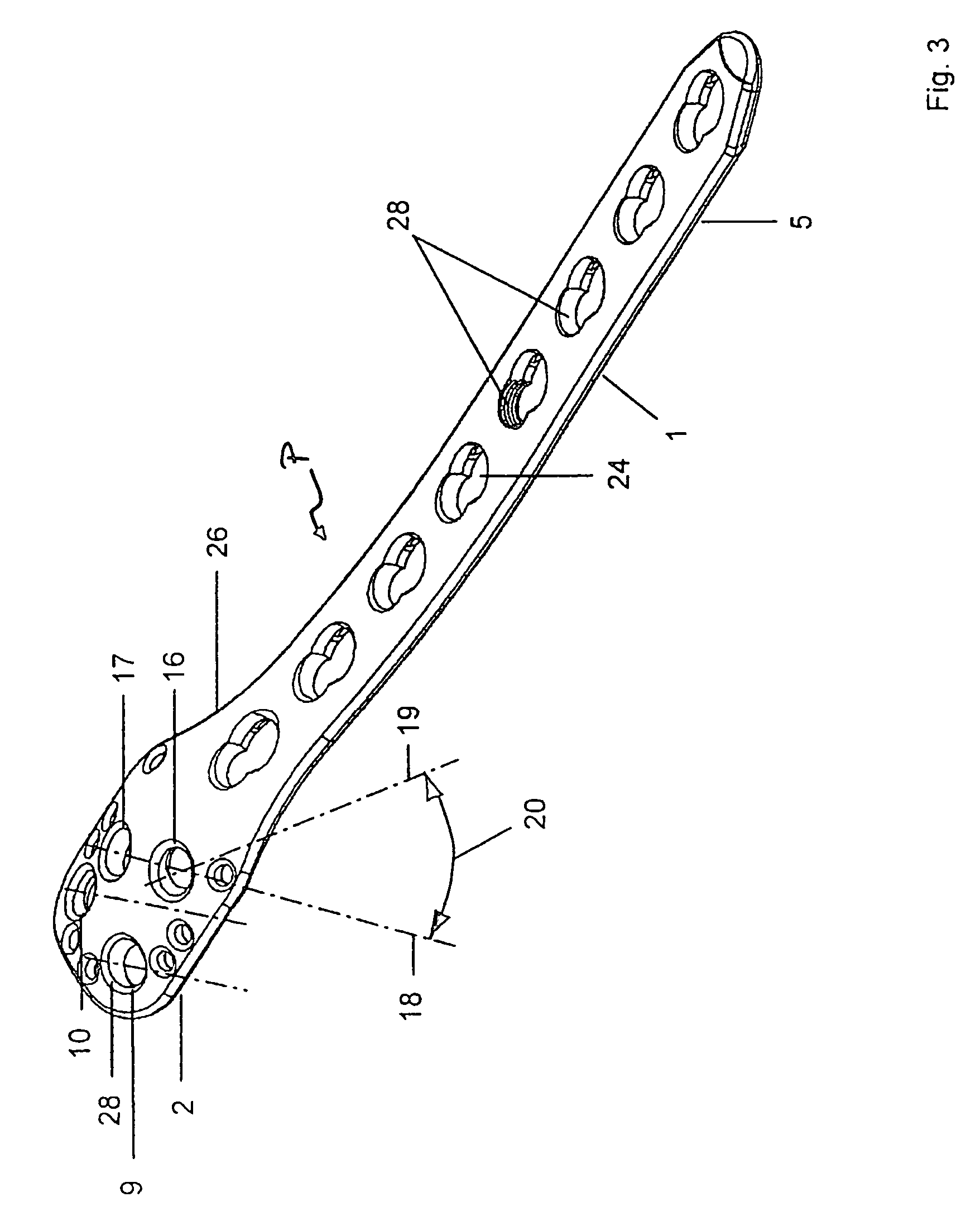 Bone plate