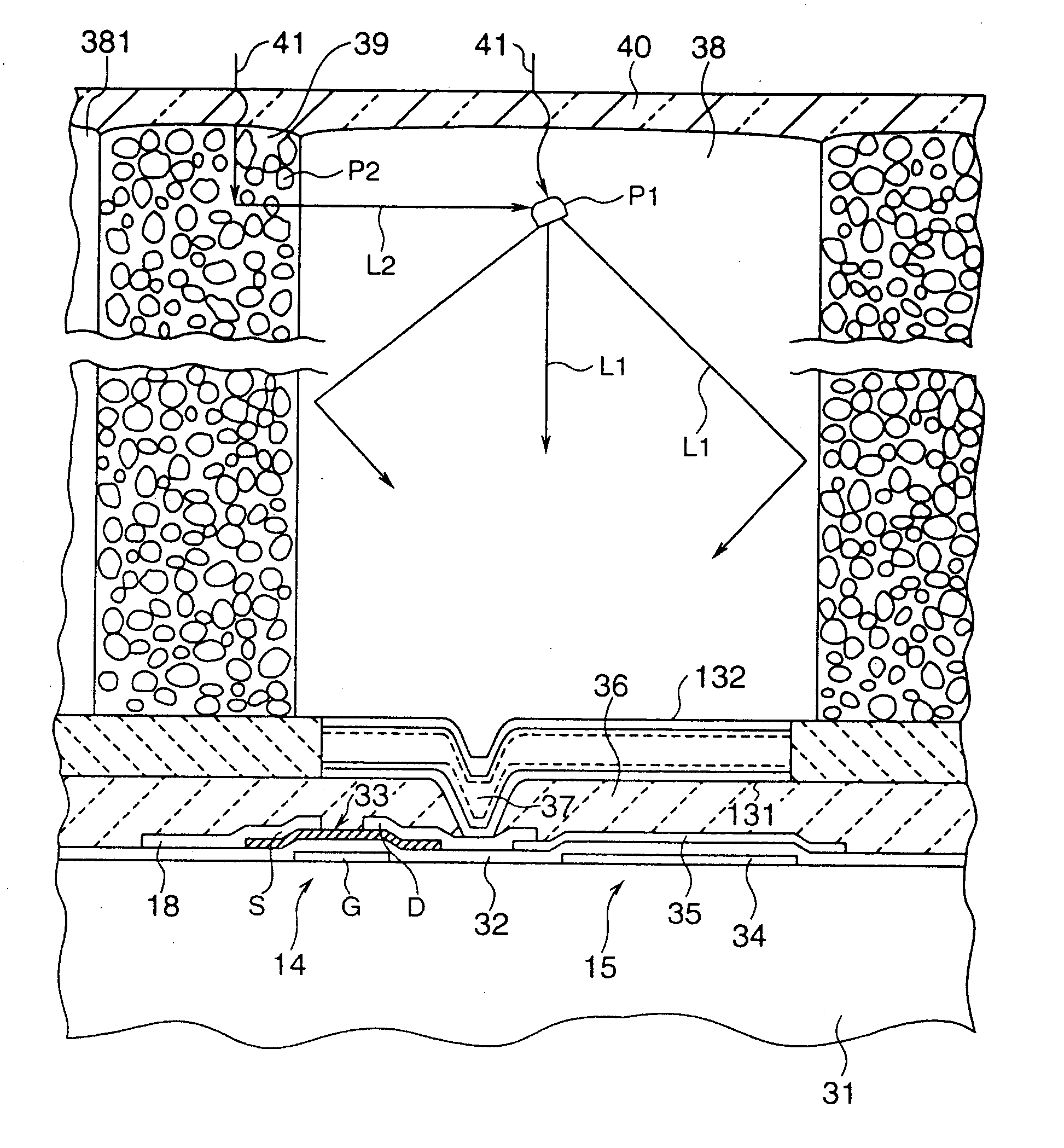 X-ray detector