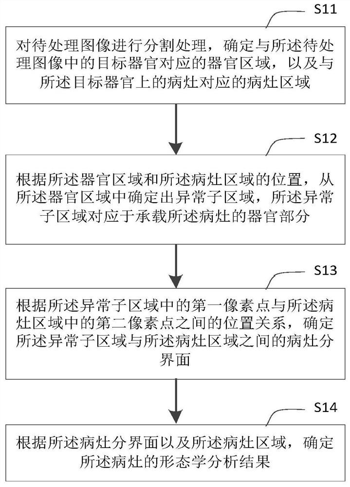 Image processing method and device, electronic equipment and storage medium