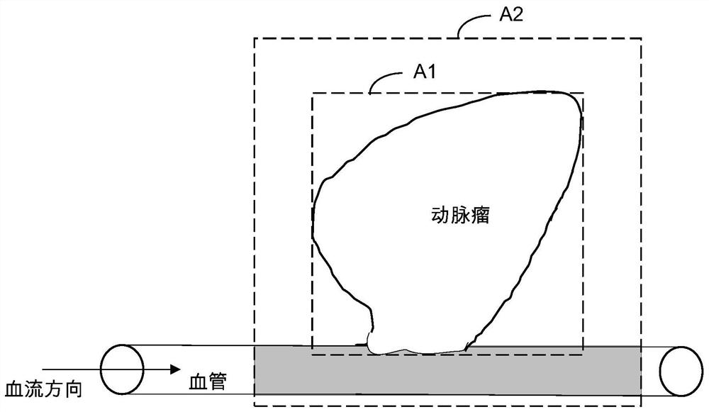 Image processing method and device, electronic equipment and storage medium