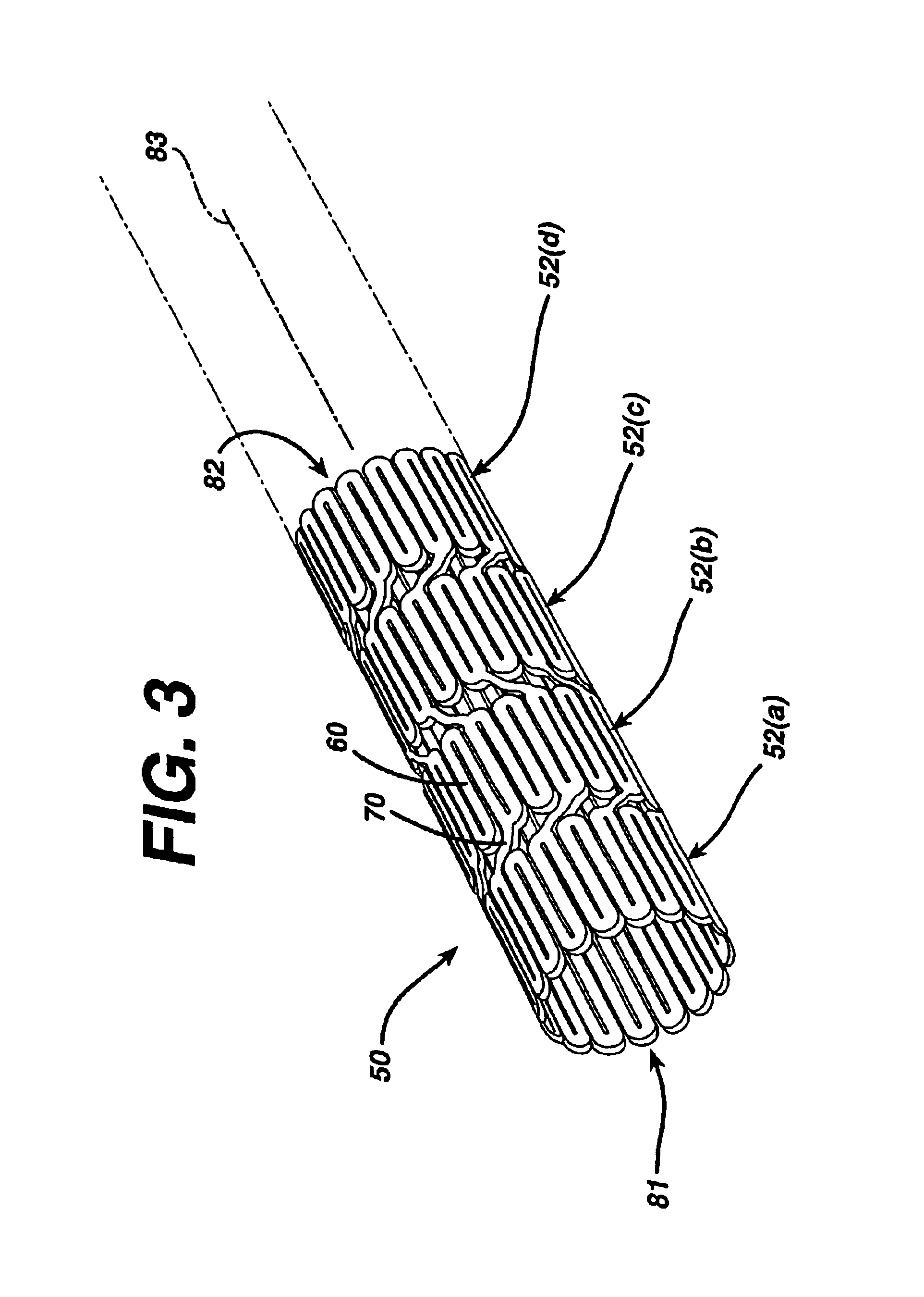 Intravascular device with improved radiopacity