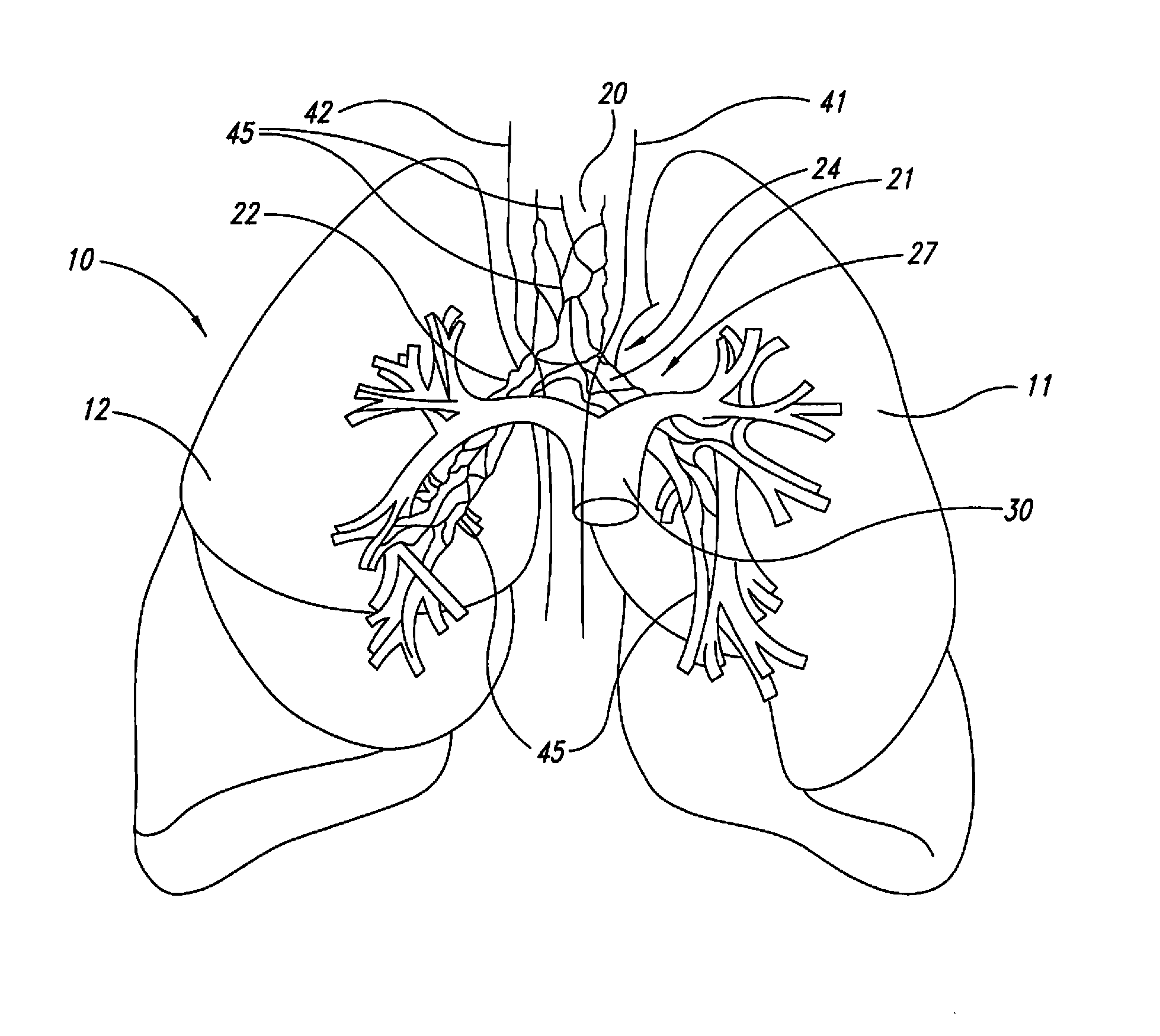 Methods for improving drug efficacy including a combination of drug administration and nerve modulation