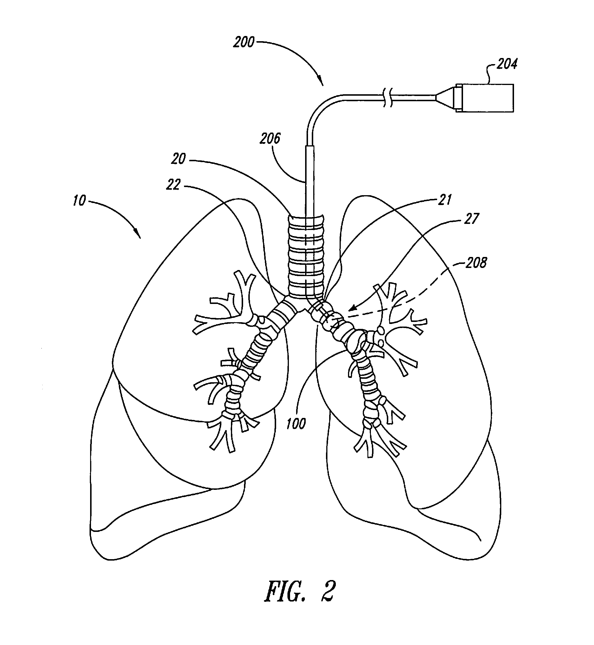 Methods for improving drug efficacy including a combination of drug administration and nerve modulation