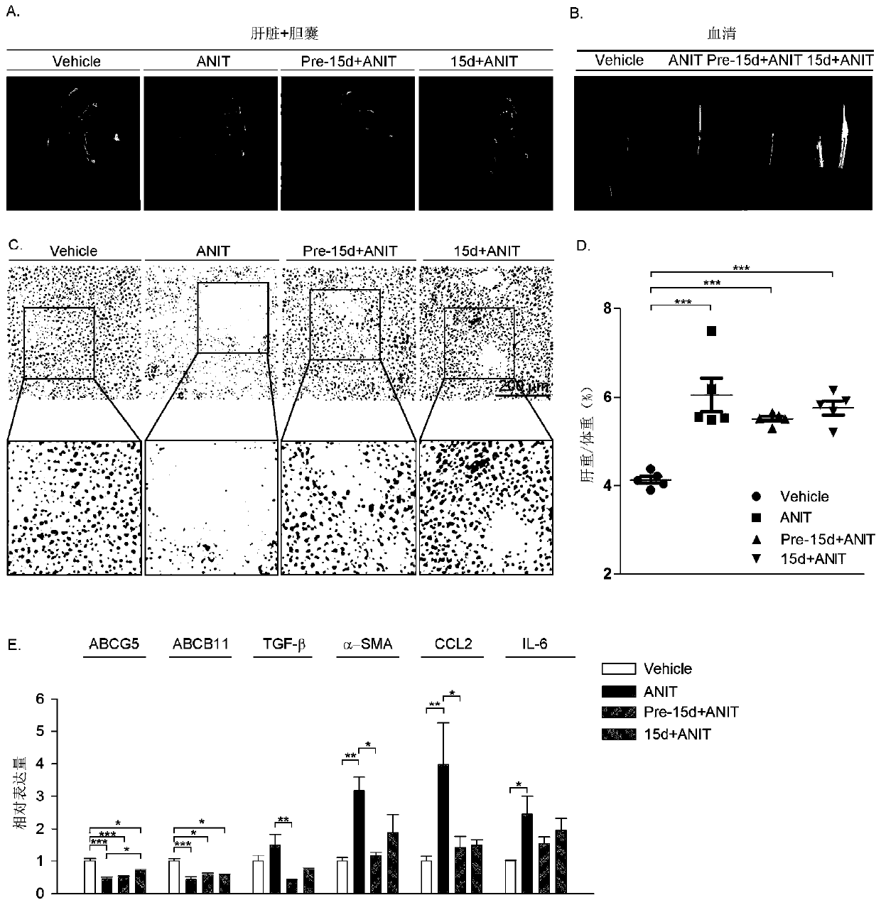 New application of 15d-PGJ2 medicine