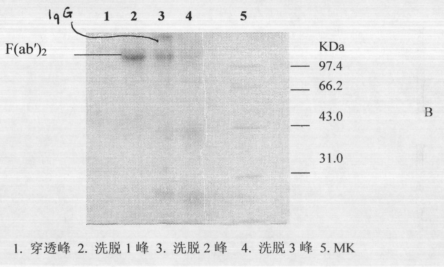 Lyophilized viper antivenin and preparation method thereof