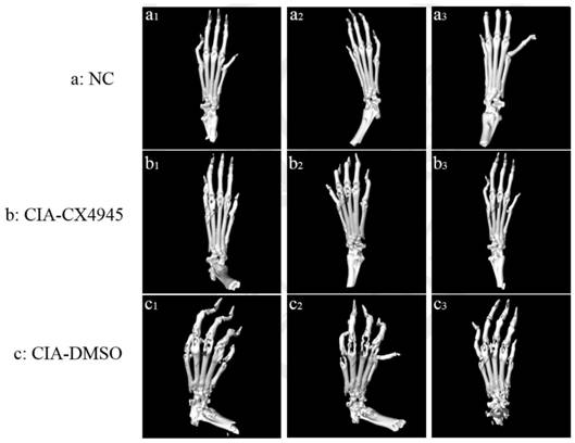 Application of CK2 inhibitor in preparation of rheumatoid arthritis treatment drugs