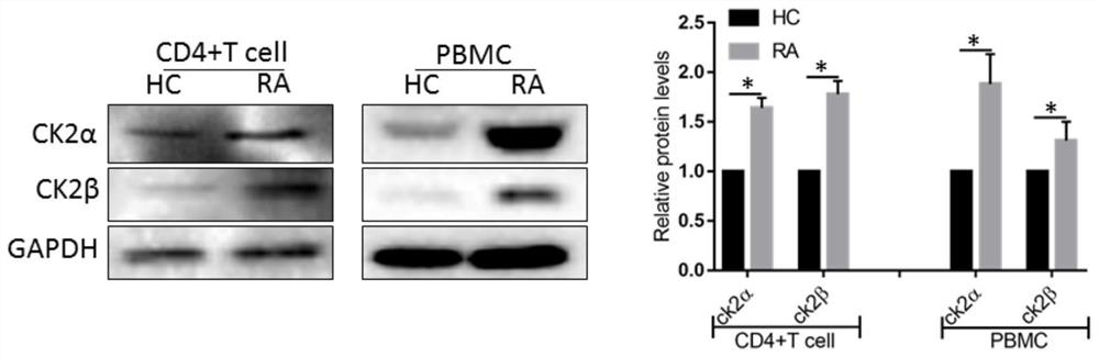 Application of CK2 inhibitor in preparation of rheumatoid arthritis treatment drugs