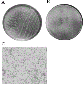 Citrobacter freundii with phosphorus-dissolving potassium-dissolving capability and application thereof